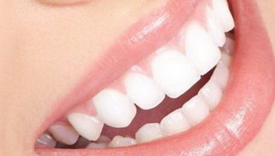 牙齿总是有牙渍_牙齿总是容易有牙渍