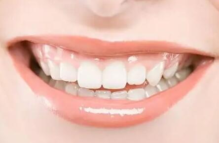 牙齿固定修复材料