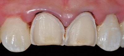 牙黄的原因是什么
