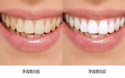 两个牙齿中间牙缝疼旁边牙齿松动(关于牙缝疼痛与牙齿松动的处理方法)