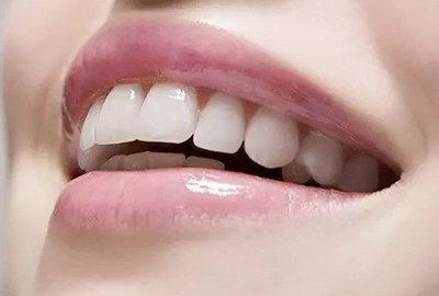 牙齿内侧黄垢是什么(牙齿内侧发黑是什么原因)