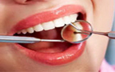 做完根管治疗牙疼吃什么药(牙疼为什么做根管治疗)
