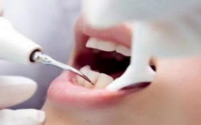 洗完牙牙齿酸痛鼻子也酸痛正常吗(洗完牙后牙齿敏感酸痛)