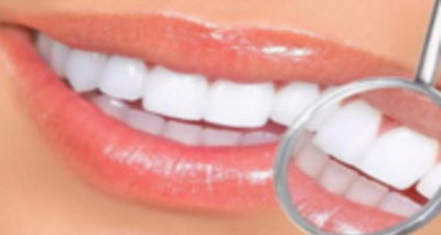 交大口腔洗牙多少钱一次_交大口腔医院种植牙多少钱
