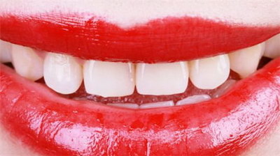 人的牙齿有几种类型(牙齿贴面有哪几种类型的)