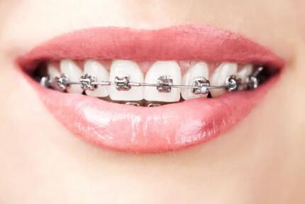 牙齿酸软是怎么治疗吃东西又不软