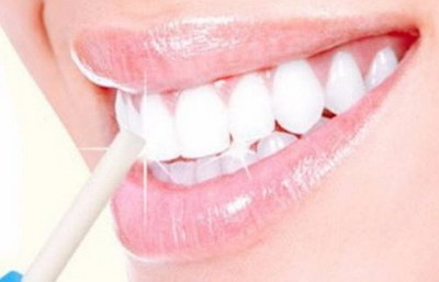牙齿种植要多久？