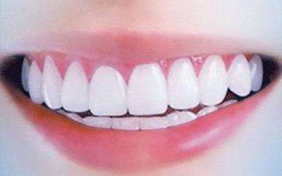 义齿是哪个牙齿(固定义齿跟种植牙齿哪个好)