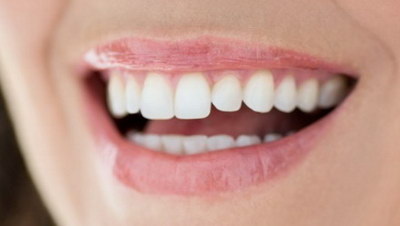 树脂美白牙齿能保持多久(纳米树脂美白牙齿能保持多久)