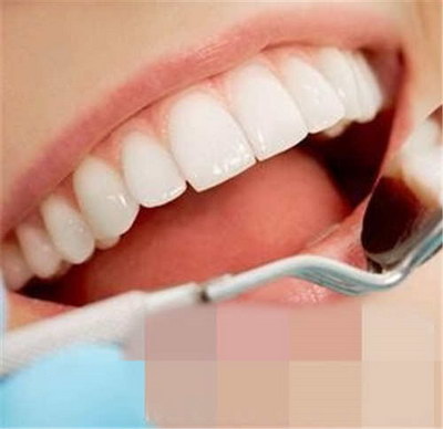 洗牙过程为什么会酸