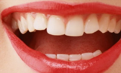 正常牙齿颜色和面积(正常牙齿的颜色图片)