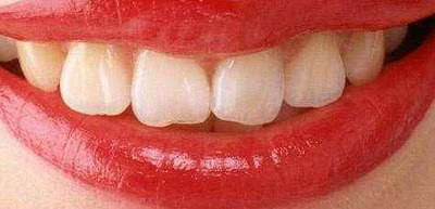 女人牙齿黄是什么原因引起的