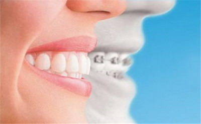 牙齿矫正的过程步骤(牙齿矫正的十四个全过程步骤)
