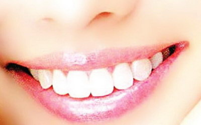 种植牙拆线后牙龈不闭合(种植牙拆线后牙龈有裂口)
