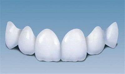 成人牙齿整形价格概览：使用多种技术实现完美微笑