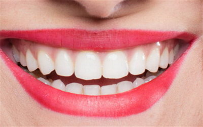 笑的时候露不出牙齿的人(为什么笑的时候露不出上排牙齿,是因为嘴小吗)