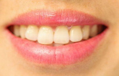 矫正牙齿大概多少钱与之相关因素？