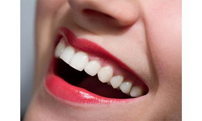 矫正正畸治疗上颌一颗尖牙齿(牙齿矫正挂什么科正畸治疗的过程)