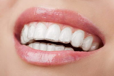 牙齿种植的过程(种植牙齿手术过程)