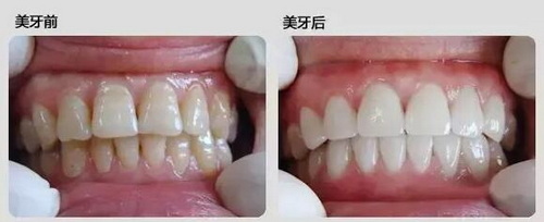 广州牙科整形医院