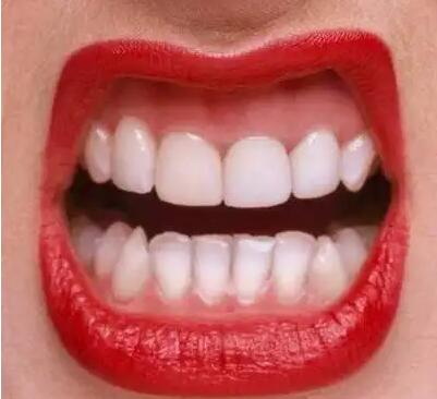 牙齿生物疗法的危害(牙齿生物科疗法)