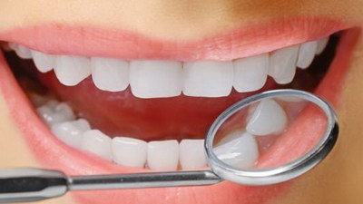 牙套分为哪几种阶段(牙套材质分为哪几种)