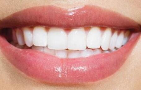 磨过的牙齿补救方法现在牙齿坏,戴牙壳的人多吗「磨过的牙齿补救方法」