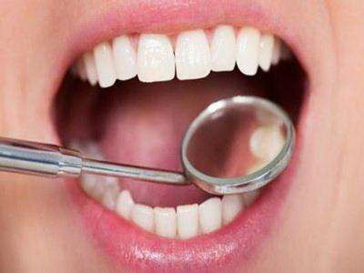镶牙后牙龈出血痛(镶牙后牙龈出血发炎用啥药)