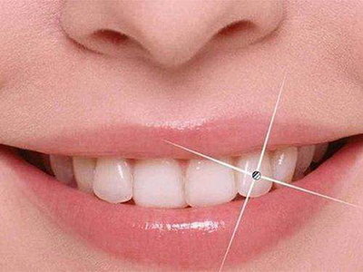 牙齿植骨手术要多久才消肿「牙齿囊肿手术后多久能刷牙」