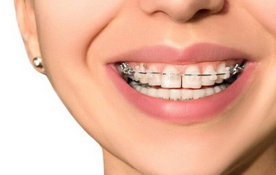 牙龈萎缩如何治理