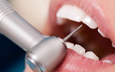 牙齿敏感治疗方法 用舒适达(牙齿敏感牙龈萎缩怎么治疗方法)