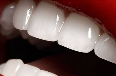 成人牙齿出血是什么原因