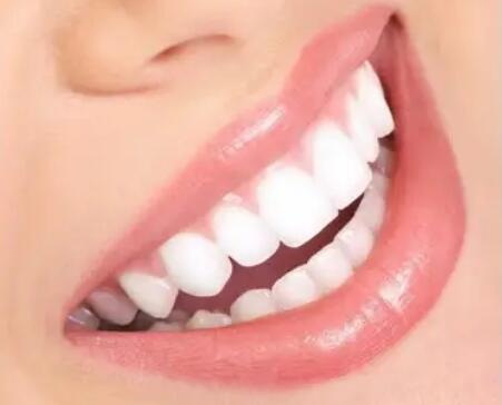 矫正后只有24颗牙齿正常吗(只有一颗牙齿不齐怎么矫正)