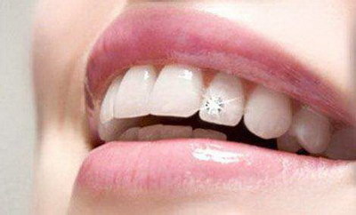 镶牙磨牙对牙齿伤害大不(镶牙磨牙对牙齿有什么伤害)