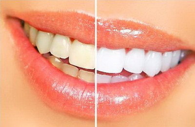 牙齿的寿命一般多长(牙齿寿命一般多长)