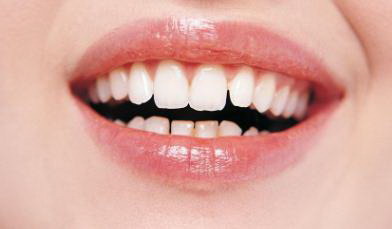 笑的时候露不出牙齿的人(为什么笑的时候露不出上排牙齿,是因为嘴小吗)