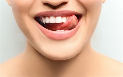 矫正正畸治疗上颌一颗尖牙齿(牙齿矫正挂什么科正畸治疗的过程)