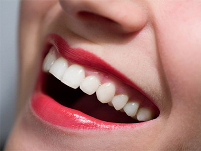 矫正后只有24颗牙齿正常吗(只有一颗牙齿不齐怎么矫正)