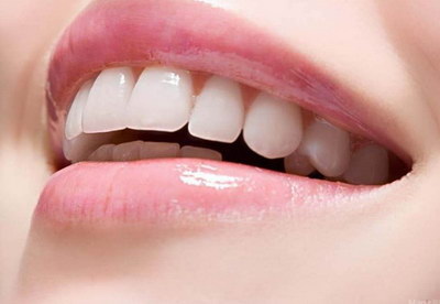 透明矫正牙套一个疗程_透明矫正牙套的评语