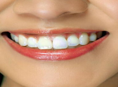 牙齿蛀一毫米需要多久(牙齿松动一毫米之内)