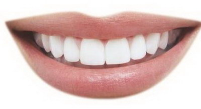 牙套什么年纪带最合适(深覆合的牙齿带什么类型的牙套最合适)