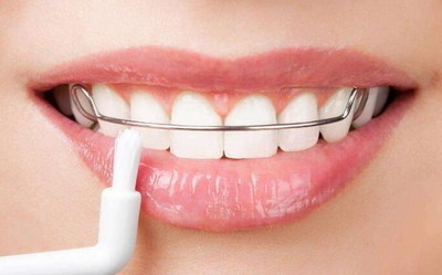 一用牙签挖牙齿就出血是什么原因(牙齿用牙签就出血是什么原因)