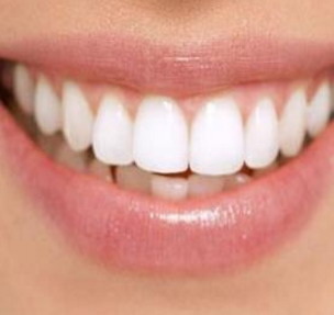 医院牙齿漂白方法