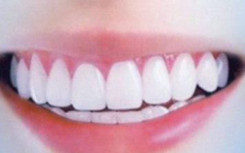 牙齿内侧变黑是什么原因(女性牙齿内侧变黑是什么原因)