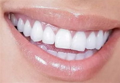 种植牙一般种几颗(缺失五颗牙一般需要种植牙几颗)