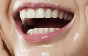 洗牙牙齿缝里有虫子怎么办「洗牙牙齿缝变大怎么办」