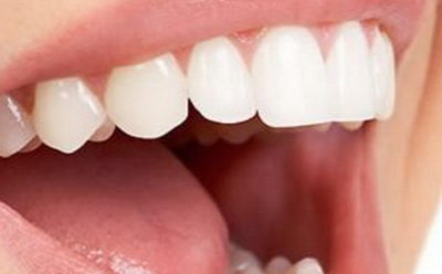 龅牙矫正术后牙龈变黑(龅牙矫正术后牙齿会松动吗)