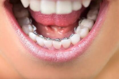 儿童牙齿长在牙龈上如何矫正