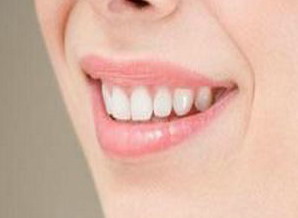标准矫正牙齿(牙齿矫正美容标准)