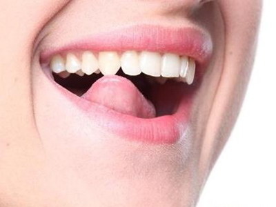 矫正牙拔牙后几天可以带牙套(矫正牙齿拔牙几天后带牙套)